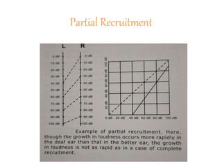 Partial Recruitment
 
