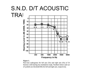 S.N.D. D/T ACOUSTIC
TRAUMA
 