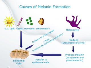 Causes of Melanin Formation
U.V. Light Genes Hormones Inflammation
Melanocyte
Produce
Tyrosinase (enzyme)
Produce Melanin
(eumelanin and
phaeomelanin)Transfer to
epidermal cells
Epidermal
Cells
Cytokine or other signals
α-MSH
(melanocyte stimulating hormone)
 