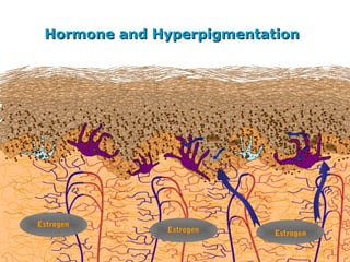 Hormone and HyperpigmentationHormone and Hyperpigmentation
Estrogen
Estrogen
Estrogen
 
