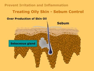 Sebum
Treating Oily Skin - Sebum Control
Over Production of Skin Oil
Sebaceous gland
Prevent Irritation and Inflammation
 