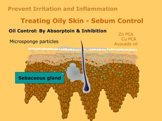 Oil Control: By Absorptoin & Inhibition
Sebaceous gland
Microsponge particles
Zn PCA
Cu PCA
Avocado oil
Treating Oily Skin - Sebum Control
Prevent Irritation and Inflammation
 