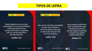 TIPOS DE LEPRA
1) - PELE - APARÊNCIA 2) - CABEÇA - RENOVAÇÃO
 
