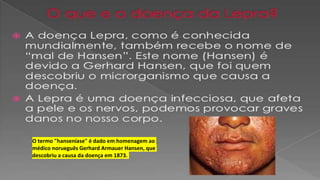 O termo "hanseníase" é dado em homenagem ao
médico norueguês Gerhard Armauer Hansen, que
descobriu a causa da doença em 1873.
 