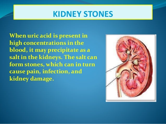 can allopurinol damage your kidneys
