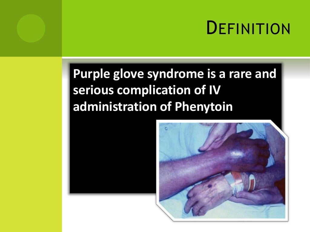 Purple glove syndrome