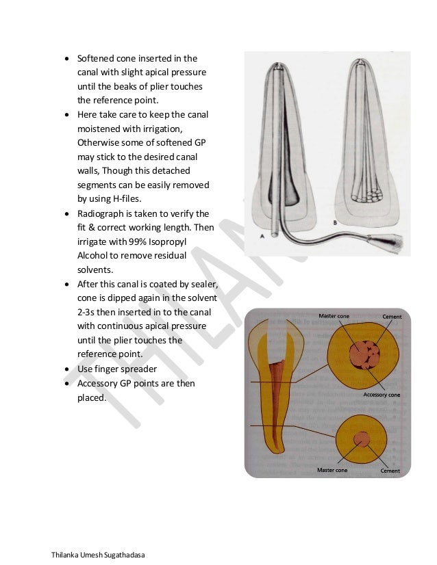 Obturation in endodontics
