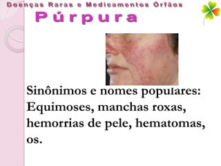 Sinônimos e nomes populares:
Equimoses, manchas roxas,
hemorrias de pele, hematomas,
os.
 