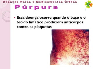    Essa doença ocorre quando o baço e o
    tecido linfático produzem anticorpos
    contra as plaquetas
 