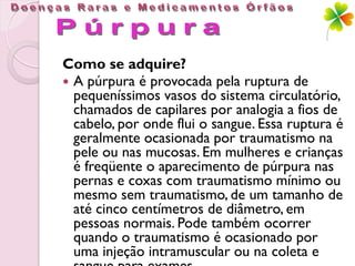 Como se adquire?
 A púrpura é provocada pela ruptura de
  pequeníssimos vasos do sistema circulatório,
  chamados de capilares por analogia a fios de
  cabelo, por onde flui o sangue. Essa ruptura é
  geralmente ocasionada por traumatismo na
  pele ou nas mucosas. Em mulheres e crianças
  é freqüente o aparecimento de púrpura nas
  pernas e coxas com traumatismo mínimo ou
  mesmo sem traumatismo, de um tamanho de
  até cinco centímetros de diâmetro, em
  pessoas normais. Pode também ocorrer
  quando o traumatismo é ocasionado por
  uma injeção intramuscular ou na coleta e
 