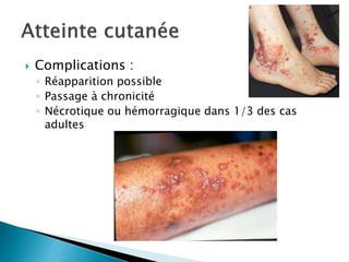  Complications :
◦ Réapparition possible
◦ Passage à chronicité
◦ Nécrotique ou hémorragique dans 1/3 des cas
adultes
 