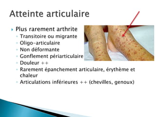  Plus rarement arthrite
◦ Transitoire ou migrante
◦ Oligo-articulaire
◦ Non déformante
◦ Gonflement périarticulaire
◦ Douleur ++
◦ Rarement épanchement articulaire, érythème et
chaleur
◦ Articulations inférieures ++ (chevilles, genoux)
 