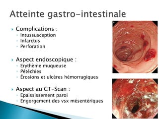 Complications :
◦ Intussusception
◦ Infarctus
◦ Perforation
 Aspect endoscopique :
◦ Erythème muqueuse
◦ Pétéchies
◦ Érosions et ulcères hémorragiques
 Aspect au CT-Scan :
◦ Epaississement paroi
◦ Engorgement des vsx mésentériques
 