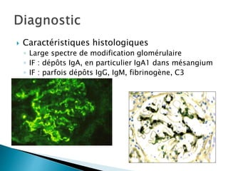  Caractéristiques histologiques
◦ Large spectre de modification glomérulaire
◦ IF : dépôts IgA, en particulier IgA1 dans mésangium
◦ IF : parfois dépôts IgG, IgM, fibrinogène, C3
 