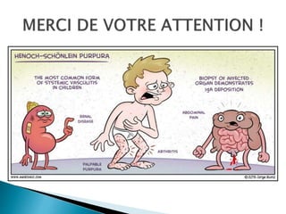 Purpura d'henoch schoenlein