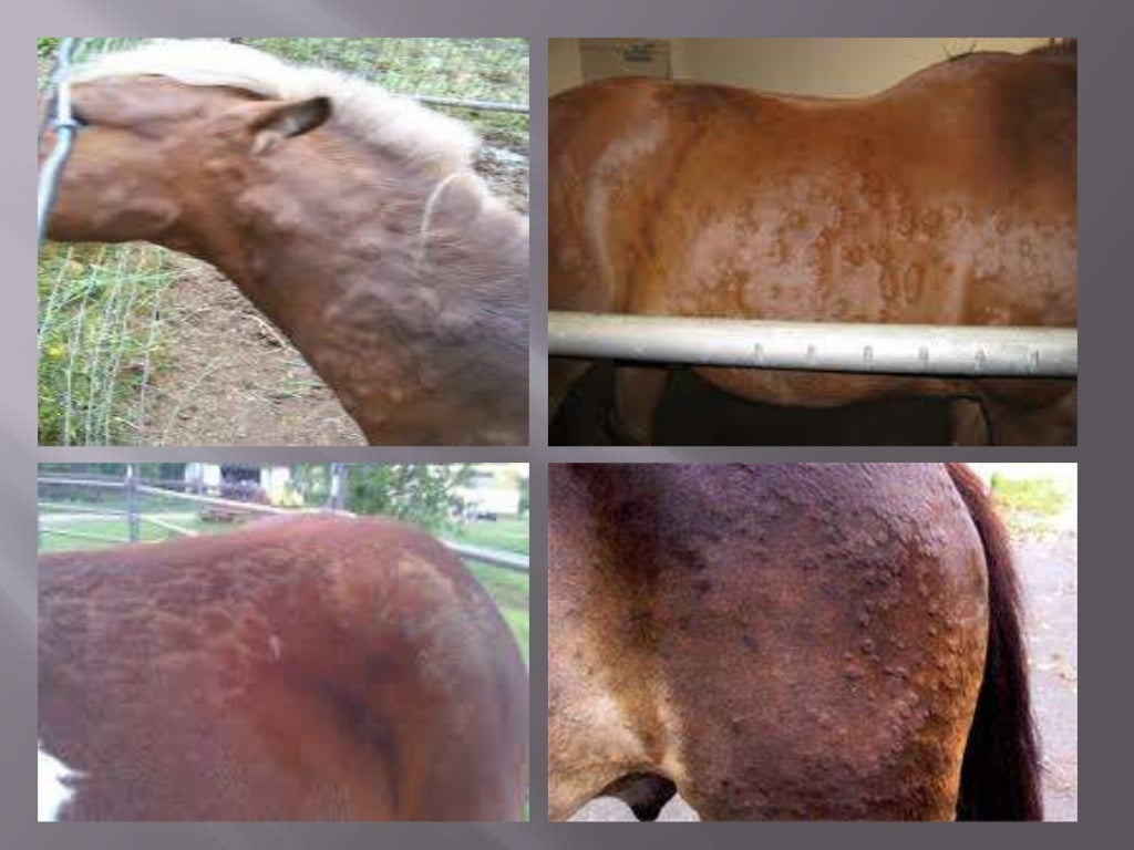 Purpura haemorrhagica