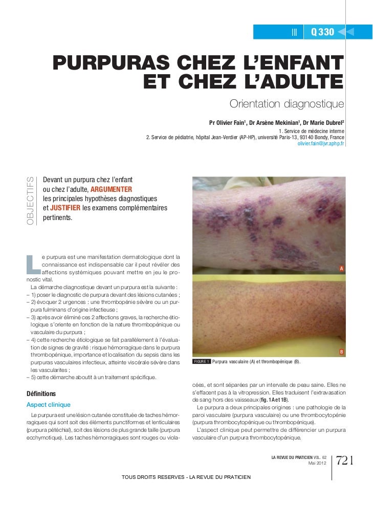 Les entozoaires dans le calmar