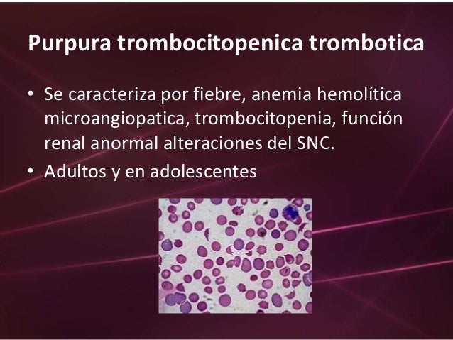 Purpuras trombocitopenicas mt