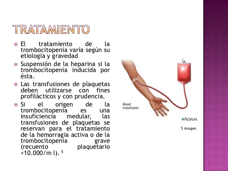 Purpura trombocitopenica