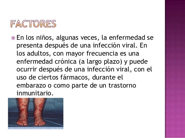 Purpura trombocitopenica por anticuerpo Purpura trombocitopenica por anticuerpo