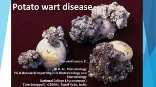 Potato wart disease
Purusothaman, C.
III B. Sc., Microbiology
PG & Research Department of Biotechnology and
Microbiology
National College (Autonomous)
Tiruchirappalli- 620001, Tamil Nadu, India
 