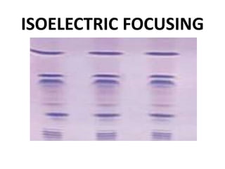 ISOELECTRIC FOCUSING
 