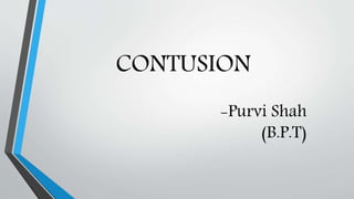 -Purvi Shah
(B.P.T)
CONTUSION
 