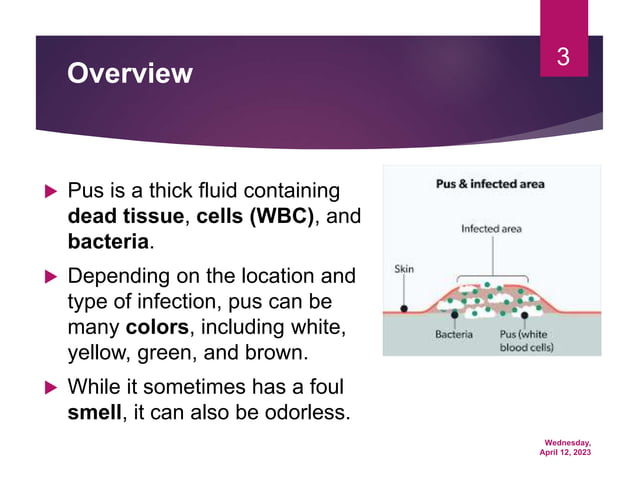 Is That Pus?  Understanding Partially Obscured Inflammatory Exudate - slqe6sv