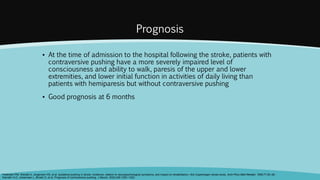 Prognosis
▪ At the time of admission to the hospital following the stroke, patients with
contraversive pushing have a more severely impaired level of
consciousness and ability to walk, paresis of the upper and lower
extremities, and lower initial function in activities of daily living than
patients with hemiparesis but without contraversive pushing
▪ Good prognosis at 6 months
Pedersen PM, Wandel A, Jorgensen HS, et al. Ipsilateral pushing in stroke: incidence, relation to neuropsychological symptoms, and impact on rehabilitation—the Copenhagen stroke study. Arch Phys Med Rehabil. 1996;77:25–28.
Karnath H-O, Johannsen L, Broetz D, et al. Prognosis of contraversive pushing. J Neurol. 2002;249:1250–1253.
 