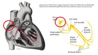 Image of heart: Public Domain. Image of Conduction system from Wikimedia user Madhero88:
https://commons.wikimedia.org/wiki/File:Electrical_conduction_system_of_the_heart.svg
 