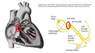 Image of heart: Public Domain. Image of Conduction system from Wikimedia user Madhero88:
https://commons.wikimedia.org/wiki/File:Electrical_conduction_system_of_the_heart.svg
 