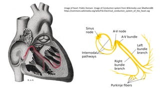 Image of heart: Public Domain. Image of Conduction system from Wikimedia user Madhero88:
https://commons.wikimedia.org/wiki/File:Electrical_conduction_system_of_the_heart.svg
 