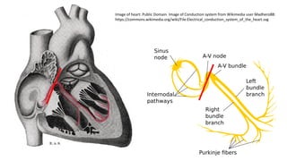 Image of heart: Public Domain. Image of Conduction system from Wikimedia user Madhero88:
https://commons.wikimedia.org/wiki/File:Electrical_conduction_system_of_the_heart.svg
 