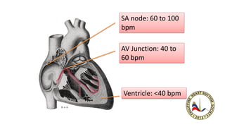 SA node: 60 to 100
bpm
AV Junction: 40 to
60 bpm
Ventricle: <40 bpm
 