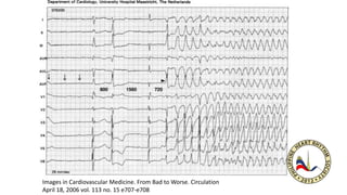 Images in Cardiovascular Medicine. From Bad to Worse. Circulation
April 18, 2006 vol. 113 no. 15 e707-e708
 