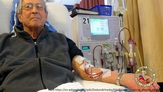 From https://en.wikipedia.org/wiki/Dialysis#/media/File:Patient_receiving_dialysis_03.jpg
 
