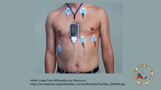 Holter image from Wikimedia user Misscurry:
https://en.wikipedia.org/wiki/Holter_monitor#/media/File:Alex_CM4000.jpg
 