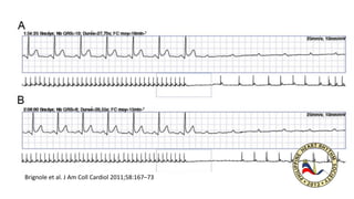 Brignole et al. J Am Coll Cardiol 2011;58:167–73
 