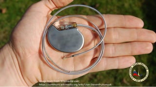 Image from From Wikimedia user:
https://commons.wikimedia.org/wiki/User:Stevenfruitsmaak
 