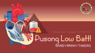 Pusong Low Batt!
B r adyarrhythmias
 