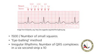 •
•
•
Image from ECGpedia,.org: http://en.ecgpedia.org/wiki/File:Ecgfreq.png
 