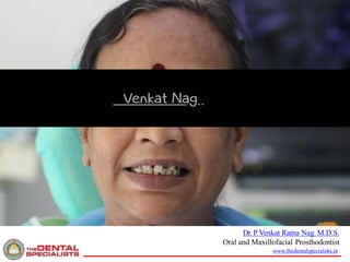 1/12/2018 1
Dr. P.Venkat Ratna Nag M.D.S.
Oral and Maxillofacial Prosthodontist
www.thedentalspecialists.in
 