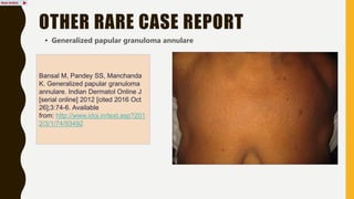 pustular granuloma annulare.pptx