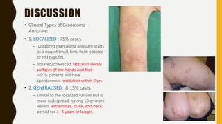 pustular granuloma annulare.pptx