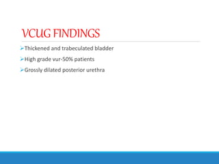 VCUGFINDINGS
Thickened and trabeculated bladder
High grade vur-50% patients
Grossly dilated posterior urethra
 