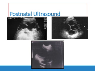 Postnatal Ultrasound
 