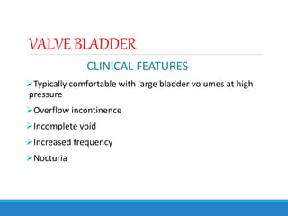 VALVEBLADDER
CLINICAL FEATURES
Typically comfortable with large bladder volumes at high
pressure
Overflow incontinence
Incomplete void
Increased frequency
Nocturia
 