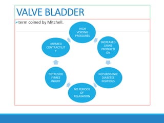VALVE BLADDER
term coined by Mitchell.
HIGH
VOIDING
PRESSURES
INCREASED
URINE
PRODUCTI
ON
NEPHROGENIC
DIABETES
INSIPIDUS
NO PERIODS
OF
RELAXATION
DETRUSOR
FIBRES
INJURY
IMPARED
CONTRACTILIT
Y
 