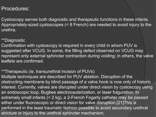 Procedures:
Cystoscopy serves both diagnostic and therapeutic functions in these infants.
Appropriately-sized cystoscopes (< 8 French) are needed to avoid injury to the
urethra.
**Diagnostic
Confirmation with cystoscopy is required in every child in whom PUV is
suggested after VCUG. In some, the filling defect observed on VCUG may
represent only external sphincter contraction during voiding; in others, the valve
leaflets are confirmed.
**Therapeutic (ie, transurethral incision of PUVs)
Multiple techniques are described for PUV ablation. Disruption of the
obstructing membrane by blind passage of a valve hook is now only of historic
interest. Currently, valves are disrupted under direct vision by cystoscopy using
an endoscopic loop, Bugbee electrocauterization, or laser fulguration. In
extremely small infants (< 2 kg), a 2-French Fogarty catheter may be passed
either under fluoroscopic or direct vision for valve disruption.[21]This is
performed in the least traumatic fashion possible to avoid secondary urethral
stricture or injury to the urethral sphincter mechanism.
 