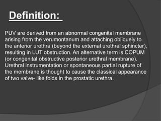 Definition:
PUV are derived from an abnormal congenital membrane
arising from the verumontanum and attaching obliquely to
the anterior urethra (beyond the external urethral sphincter),
resulting in LUT obstruction. An alternative term is COPUM
(or congenital obstructive posterior urethral membrane).
Urethral instrumentation or spontaneous partial rupture of
the membrane is thought to cause the classical appearance
of two valve- like folds in the prostatic urethra.
 